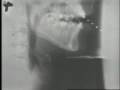 Ken Stevens x-ray film