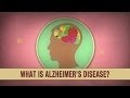 What is Alzheimer's disease? - Ivan Seah Yu Jun